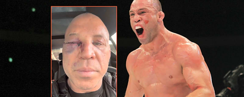 Wanderlei Silva breaks his silence after brutal KO in post-fight brawl left him in hospital with gruesome injury