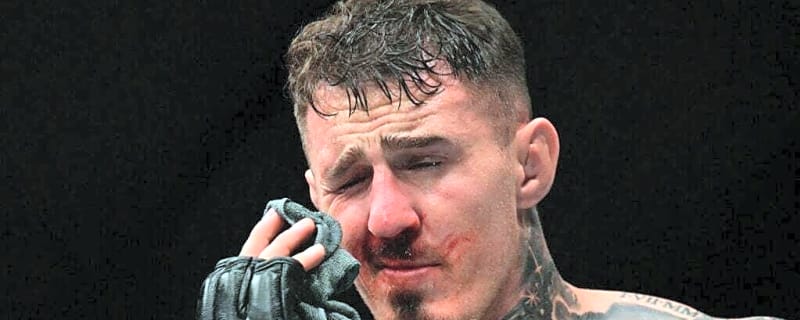 Tom Aspinall outlines new approach for UFC comeback following frightening eye injury