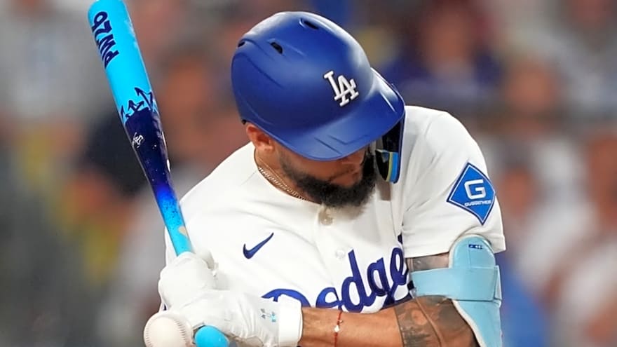 Andy Pages Potentially Needs Surgery For Left Hand Fracture
