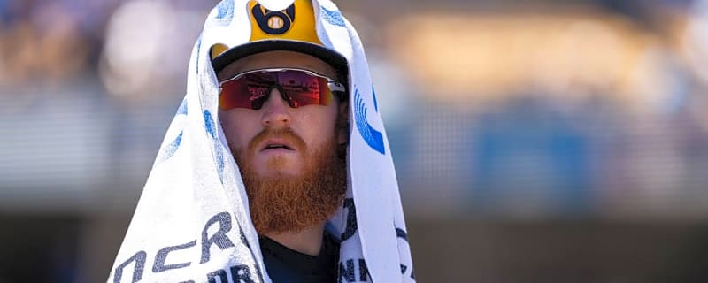Brewers Make Dustin May Decision Days After Being Struck by Comebacker