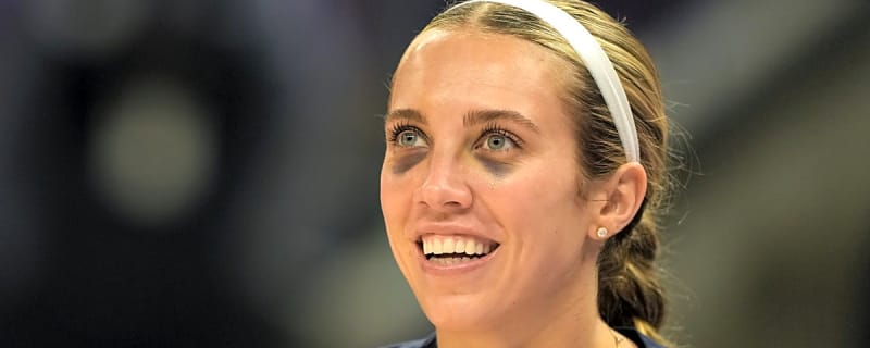 Indiana Fever Star Lexie Hull Makes Admission About Her Black Eyes