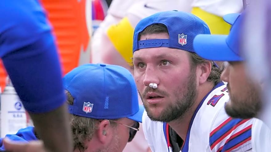 Bills&#39; head coach turning Josh Allen&#39;s bloody nose into comic relief