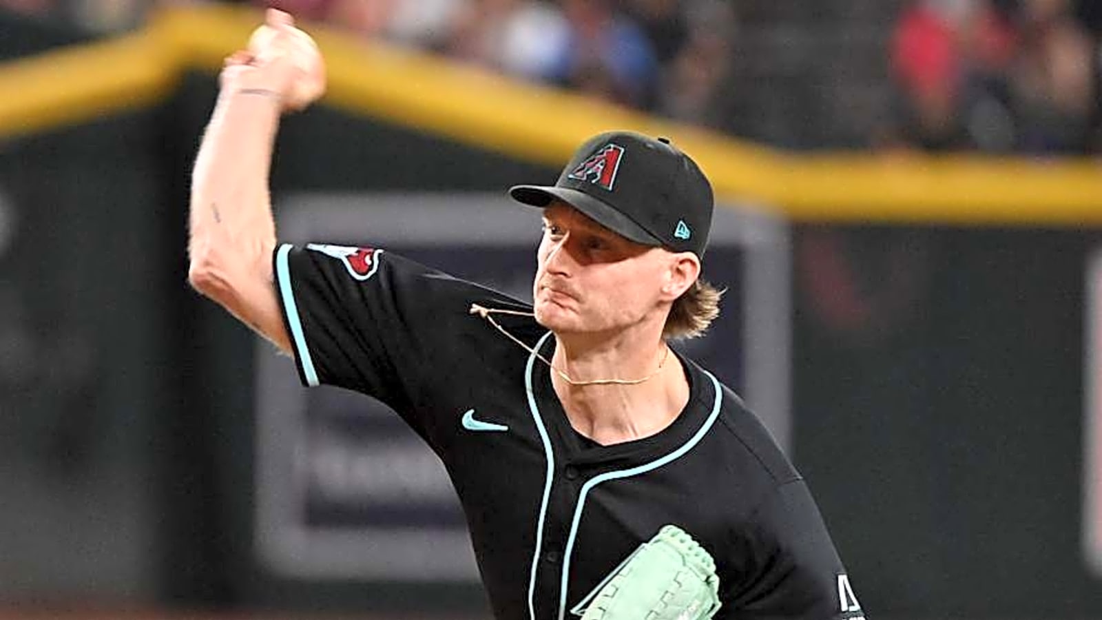 Former D-backs Closer Has Elbow Surgery