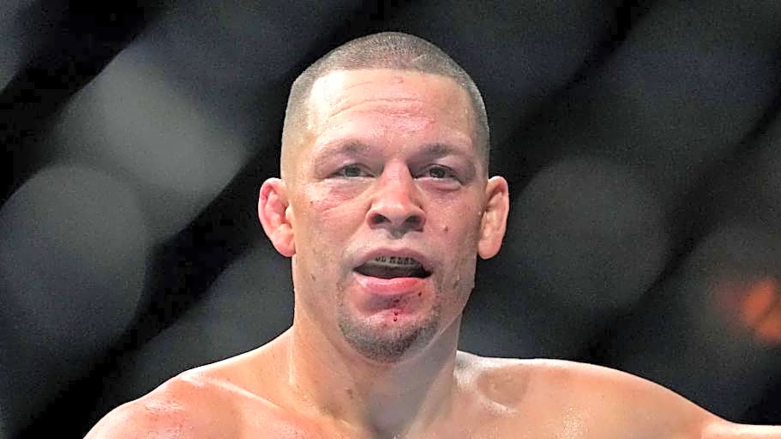 Why Nate Diaz Will Not Join BKFC 'Right Now'