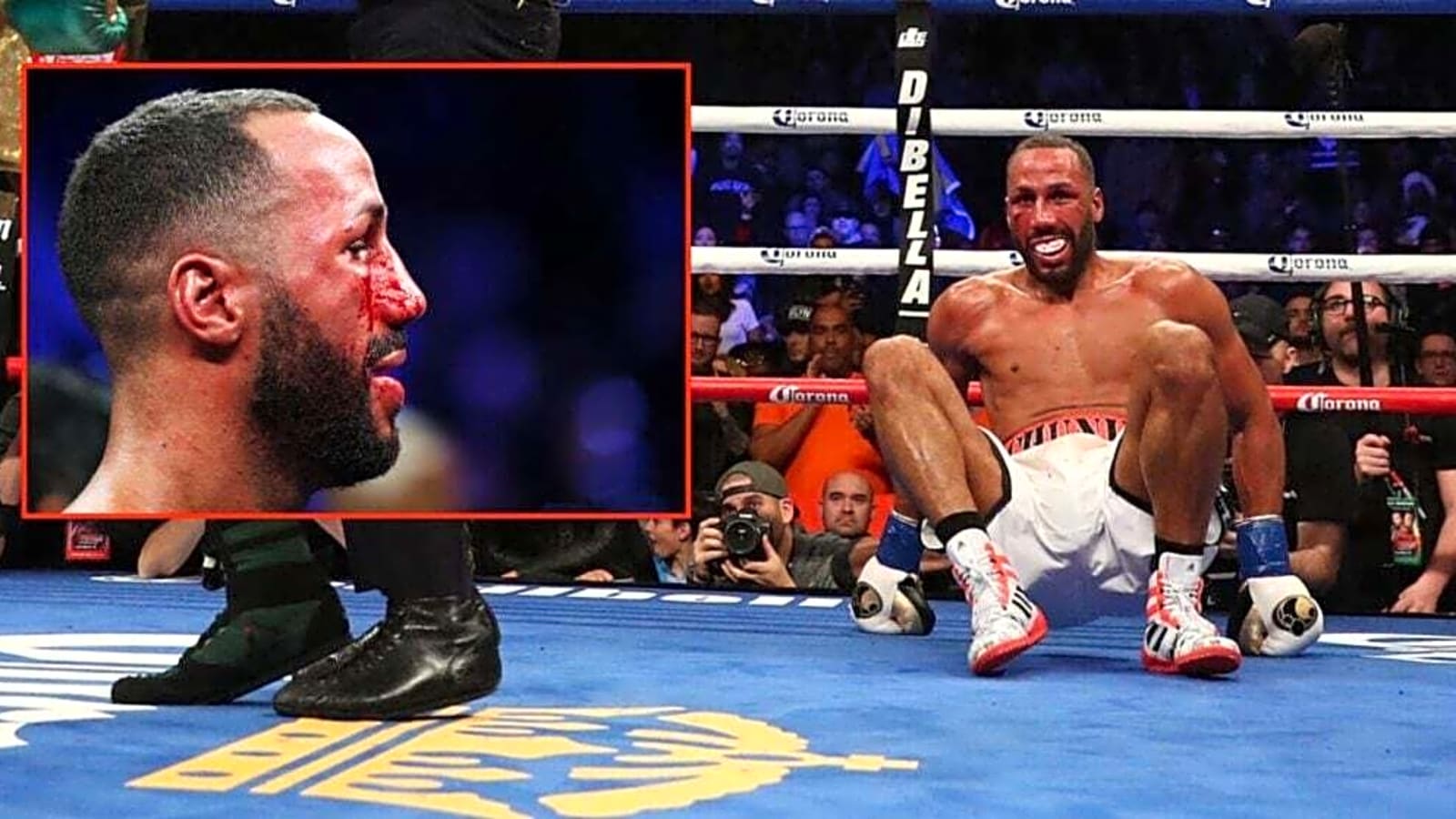 James DeGale was left bloody, bruised and without his front teeth 8 years before bare-knuckle switch