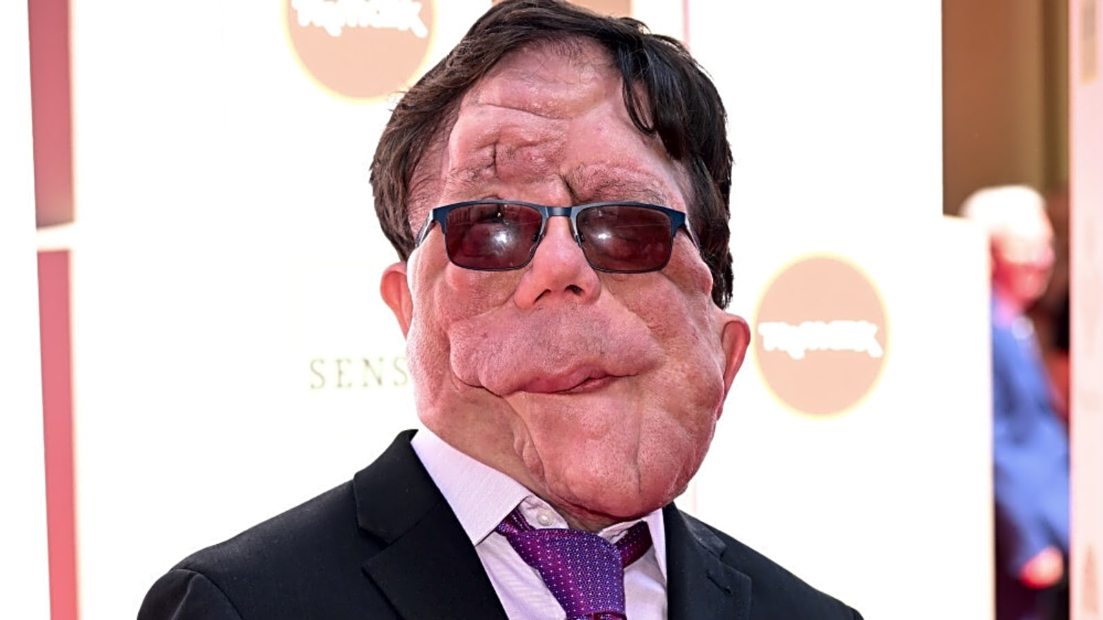 Adam Pearson &#39;beyond honoured&#39; to star in Elephant Man remake