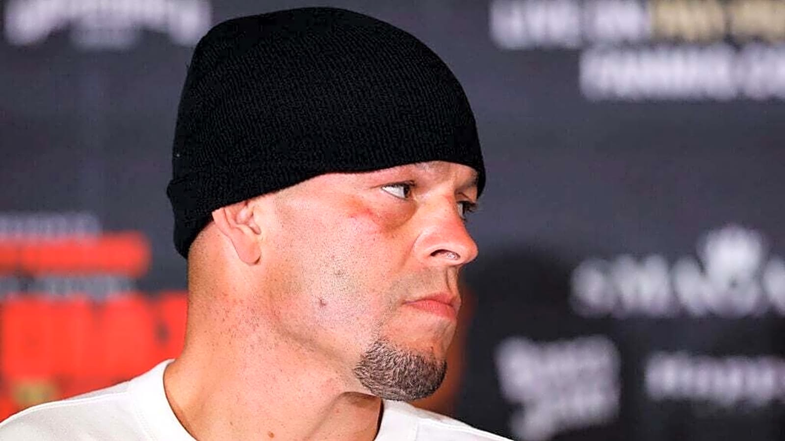 Nate Diaz apologizes to Charles Oliveira for Max Holloway ‘slap’ comments