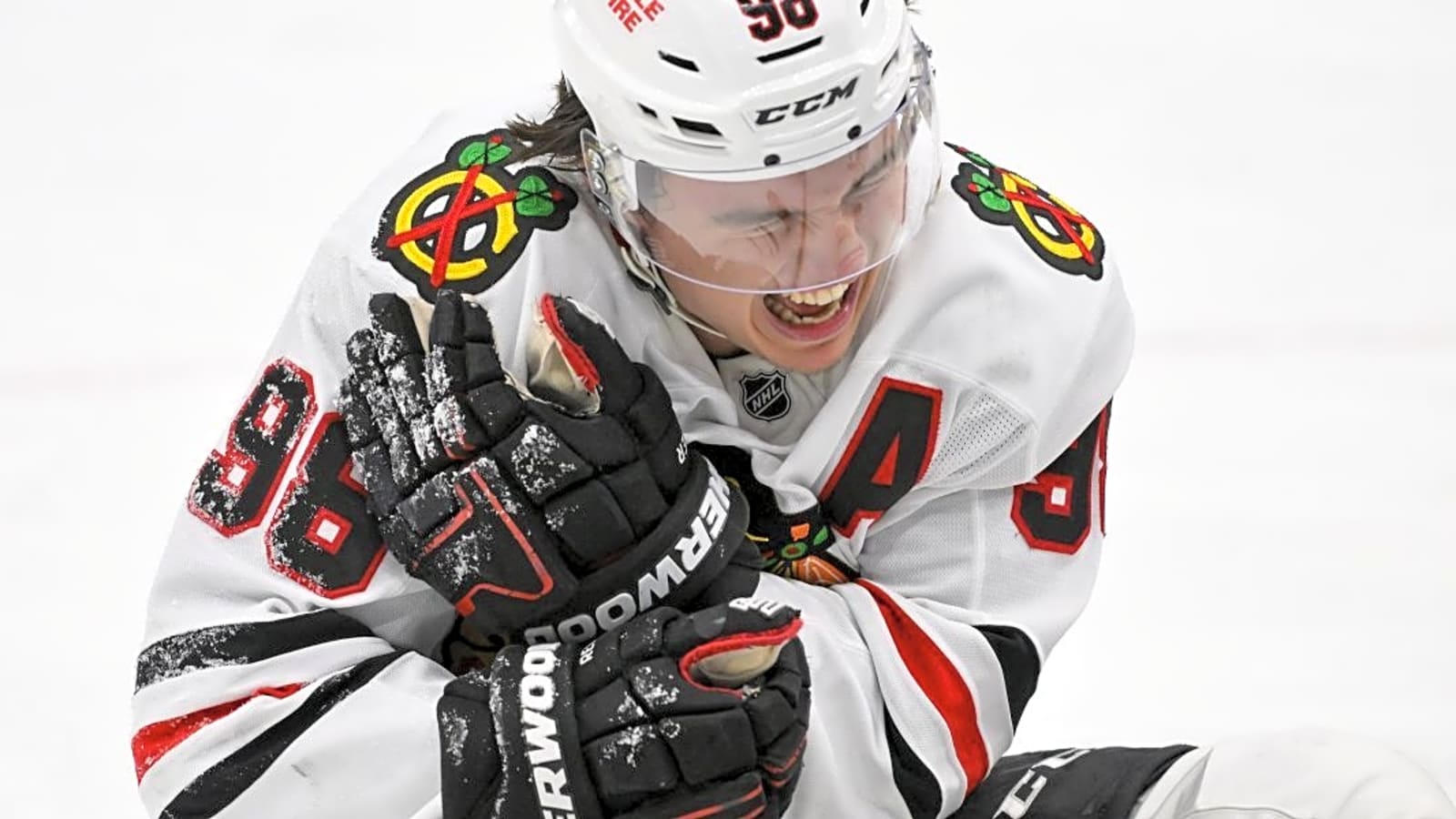Chicago Blackhawks’ Connor Bedard has offseason injury scare