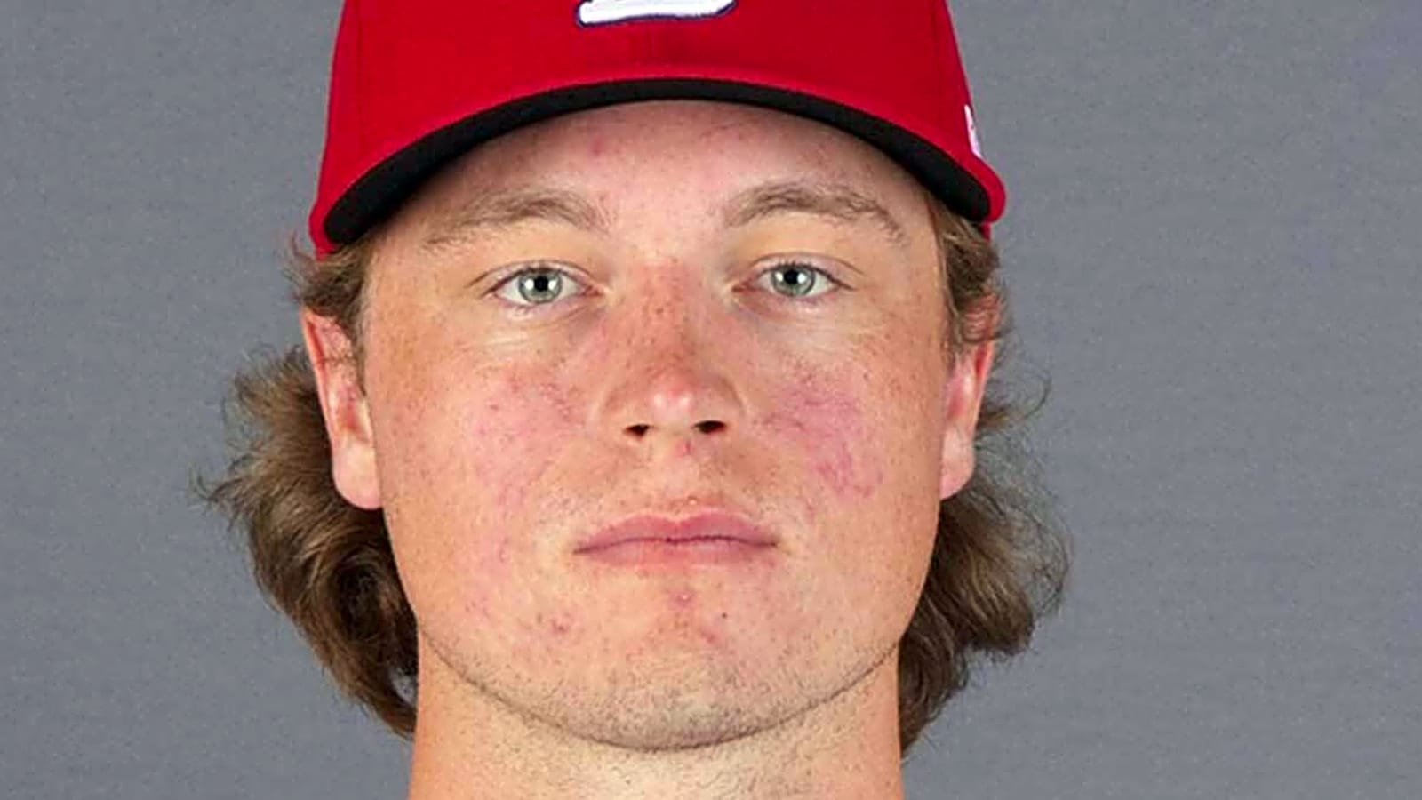 Cardinals’ No. 2 pitching prospect undergoes Tommy John surgery