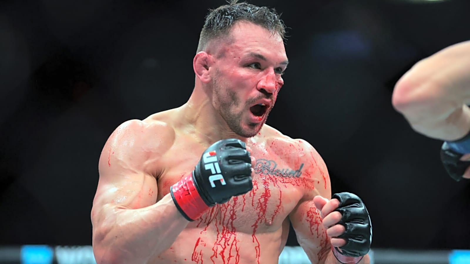 Gruesome Photo of Injury From Saturday’s UFC 314 Is Going Viral