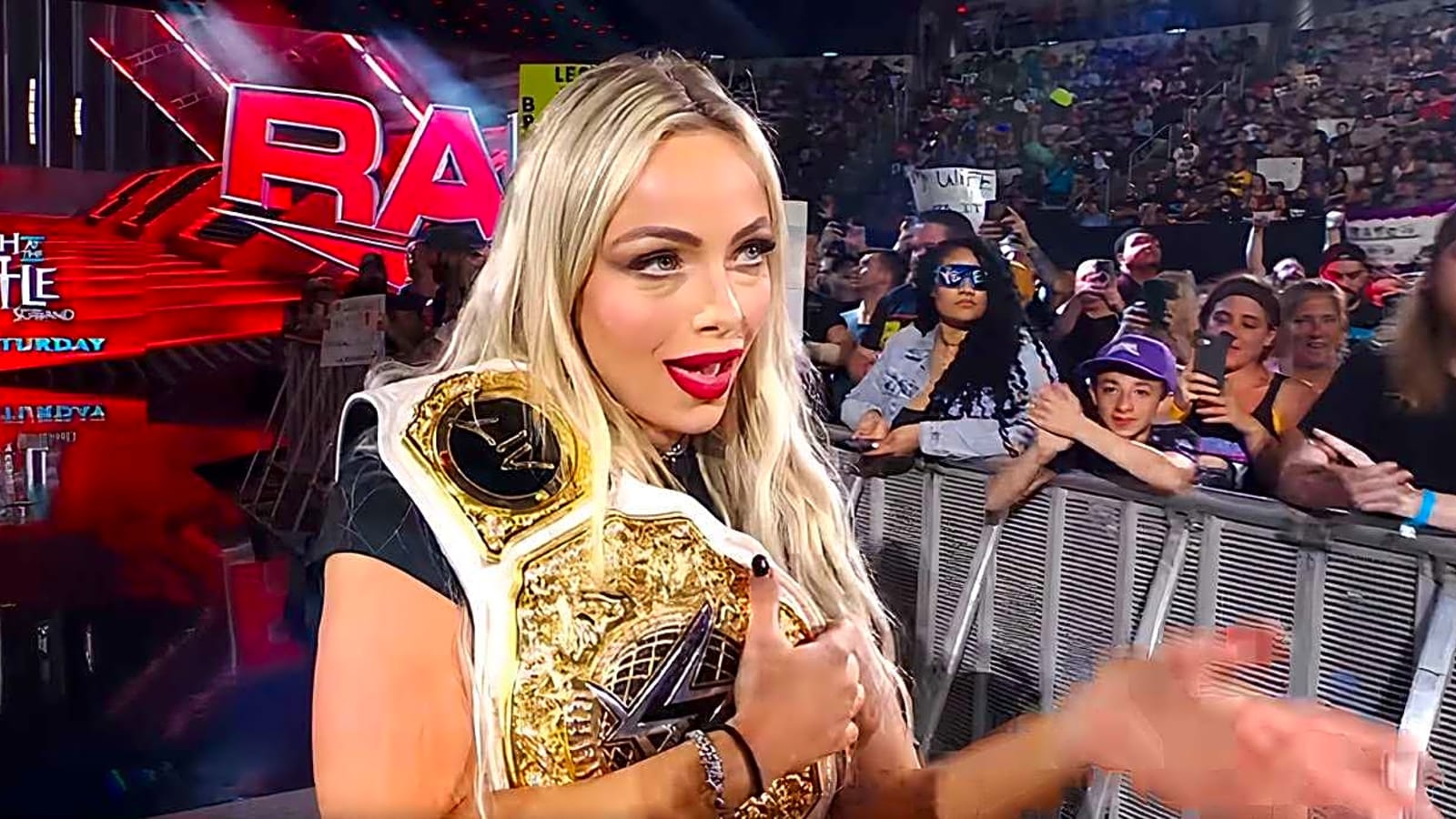 Liv Morgan Shares Photos Of The Gnarly Injury She Suffered Backstage On Raw