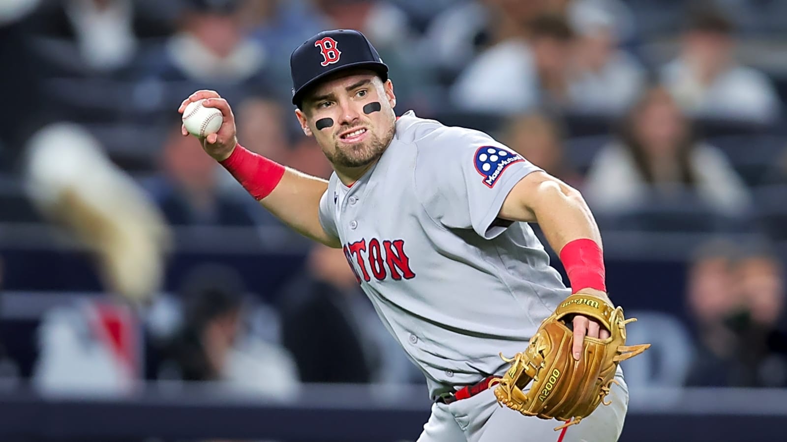 Caleb Durbin Undergoes Foot Surgery