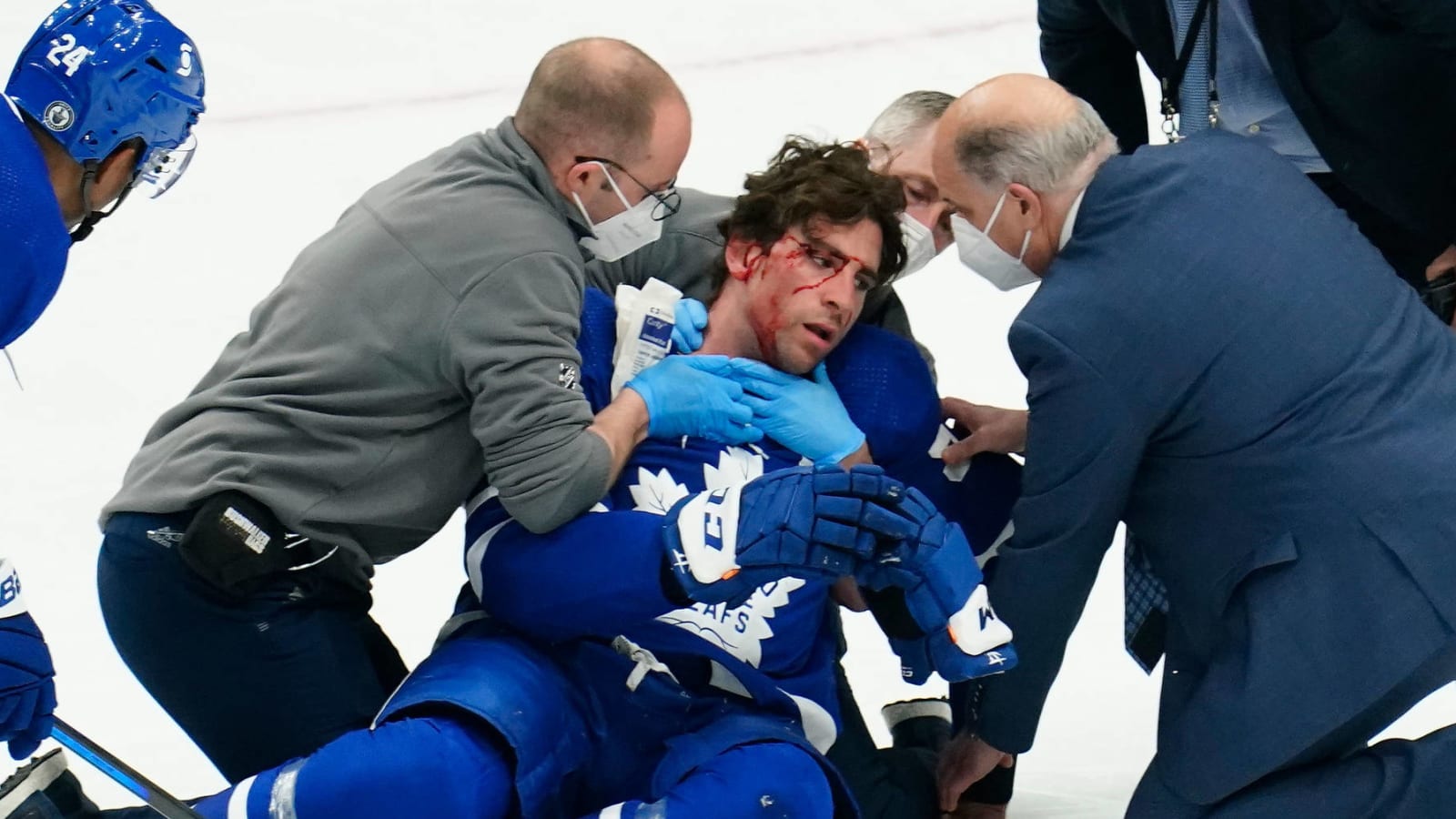 Maple Leafs' John Tavares skates 1 week after scary injury – The Denver Post