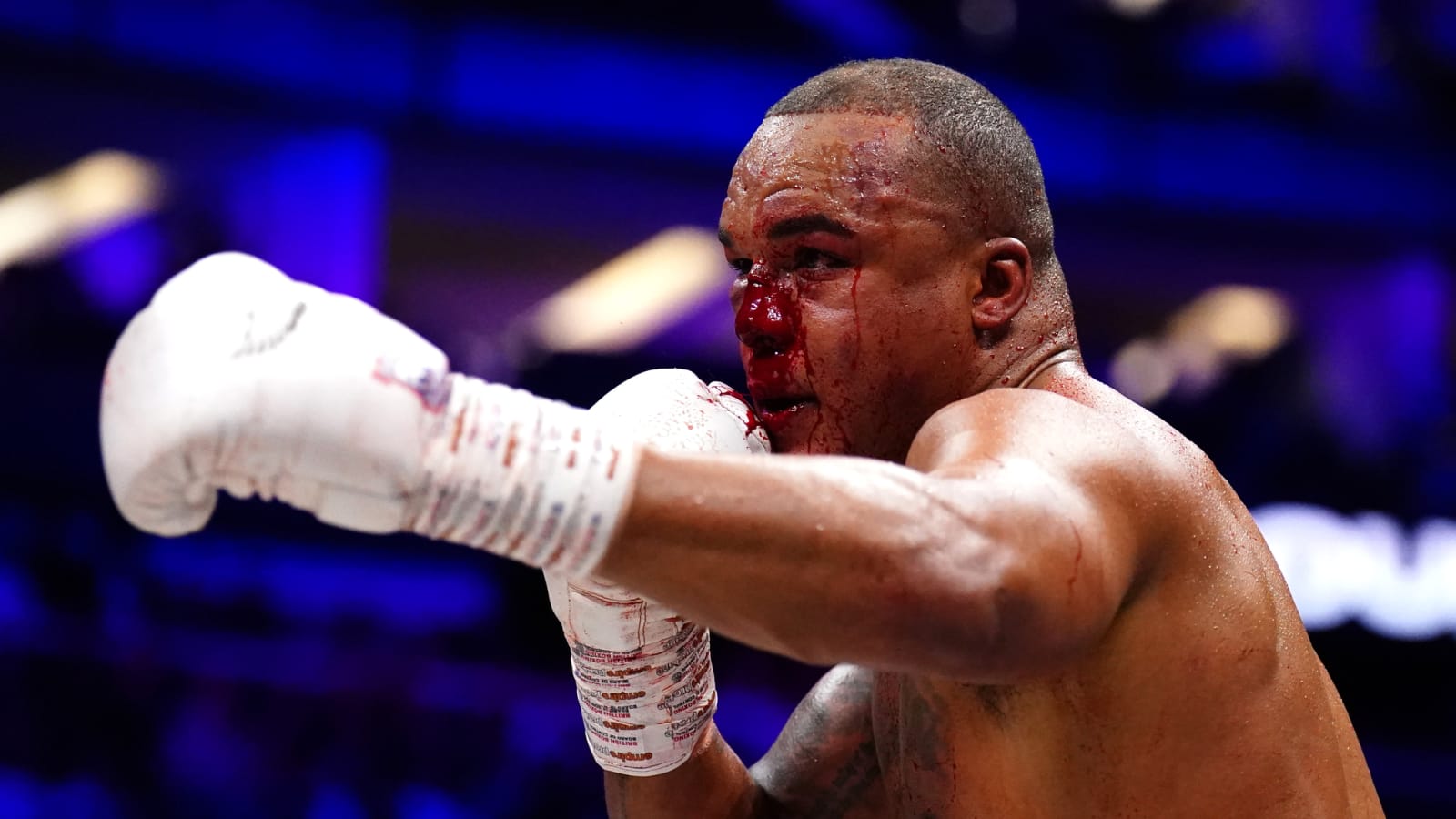 Frazer Clarke Has Surgery After Wardley KO