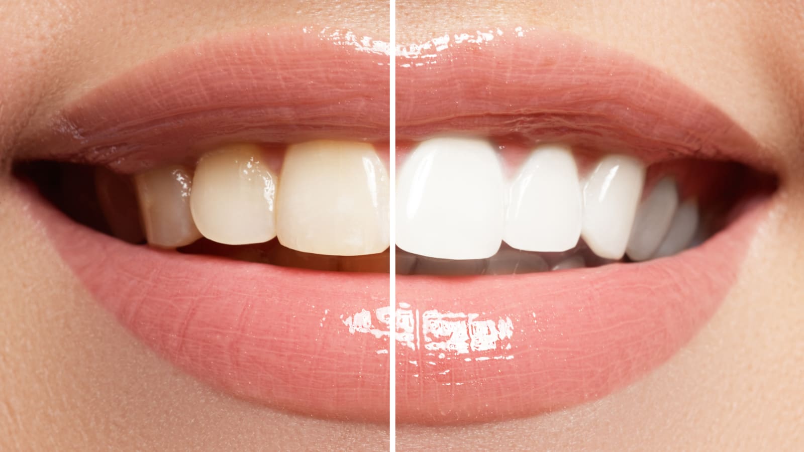 20 tips to keep your teeth pearly white
