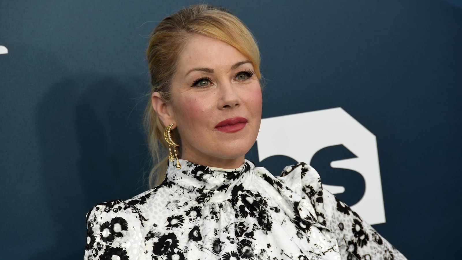 Christina Applegate Reveals Multiple Sclerosis Diagnosis Yardbarker 