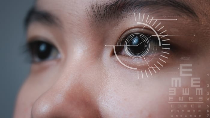 Laser cataract surgery