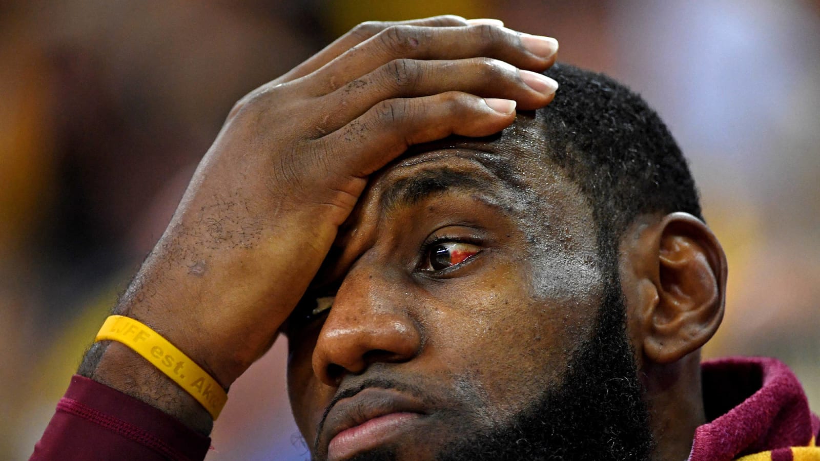 LeBron James' eye is still freaky, and fans can't stop talking about it
