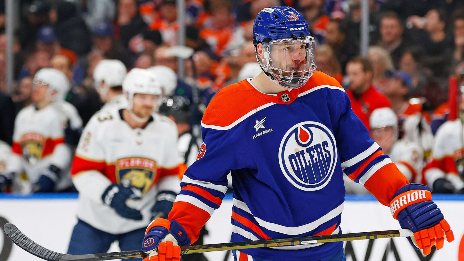 ‘It sounded like a bag of chips’: Oilers’ Zach Hyman talks broken nose after getting hit with puck