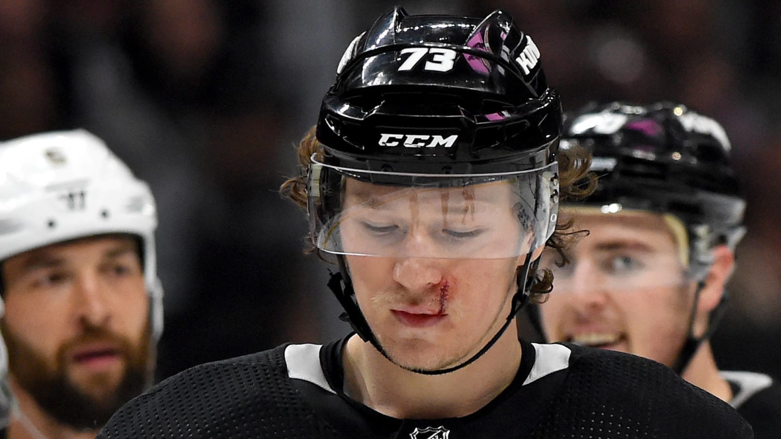 Kings’ Tyler Toffoli returns after taking puck to face