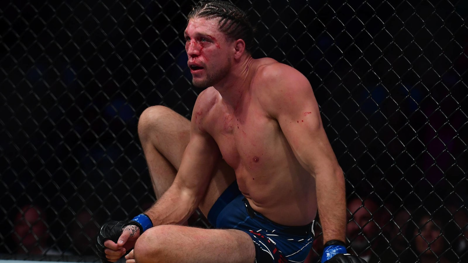 Brian Ortega Suffered Significant Cut Above Eye Three Weeks Before UFC Mexico Bout