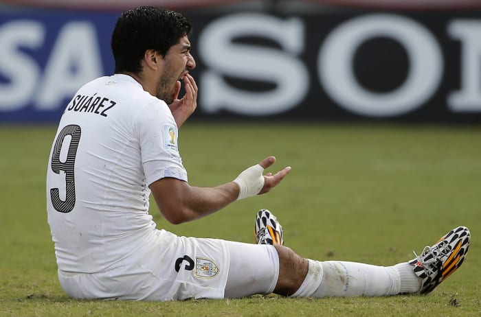 Luis Suarez bite