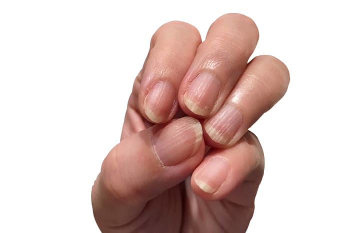 Use a ridge filler to improve the appearance of nails