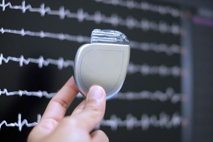 Implantable pacemaker