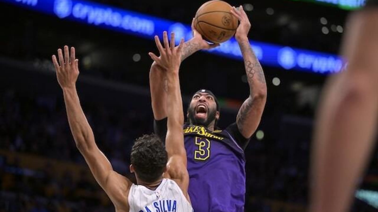  Anthony Davis Frustrated Woth Missed Free Throws Down Stretch Vs. Magic