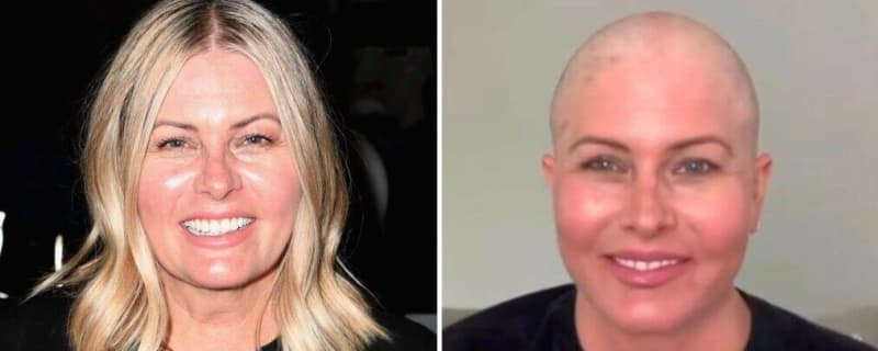 ‘Baywatch’ Star Nicole Eggert Shares Video Shaving Head Amid Cancer Battle