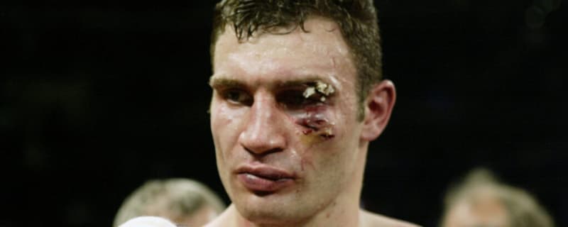 Vitali Klitschko lost world title fight due to a gruesome cut before his incredible heavyweight title reign