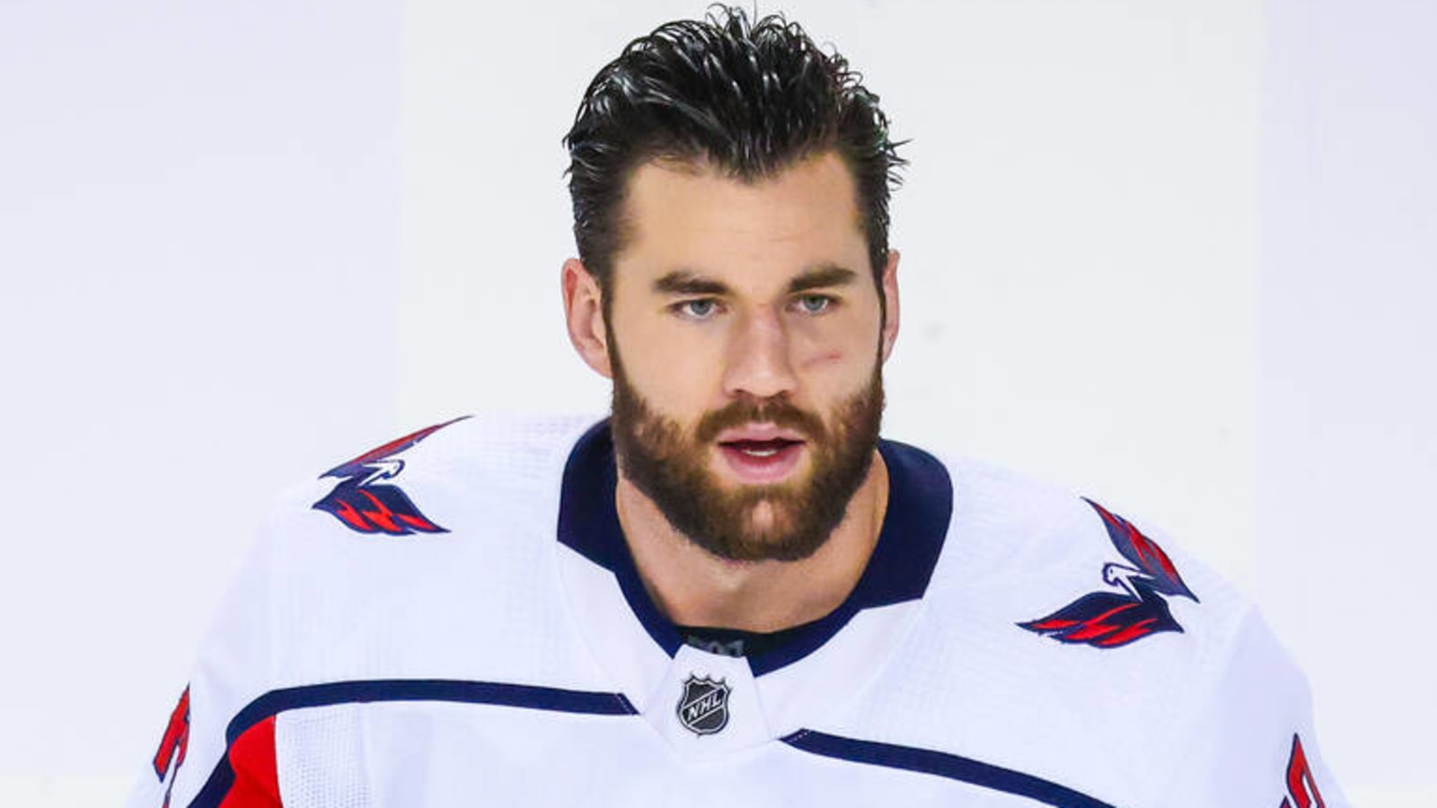 Capitals' Tom Wilson faces lengthy suspension after high-stick incident