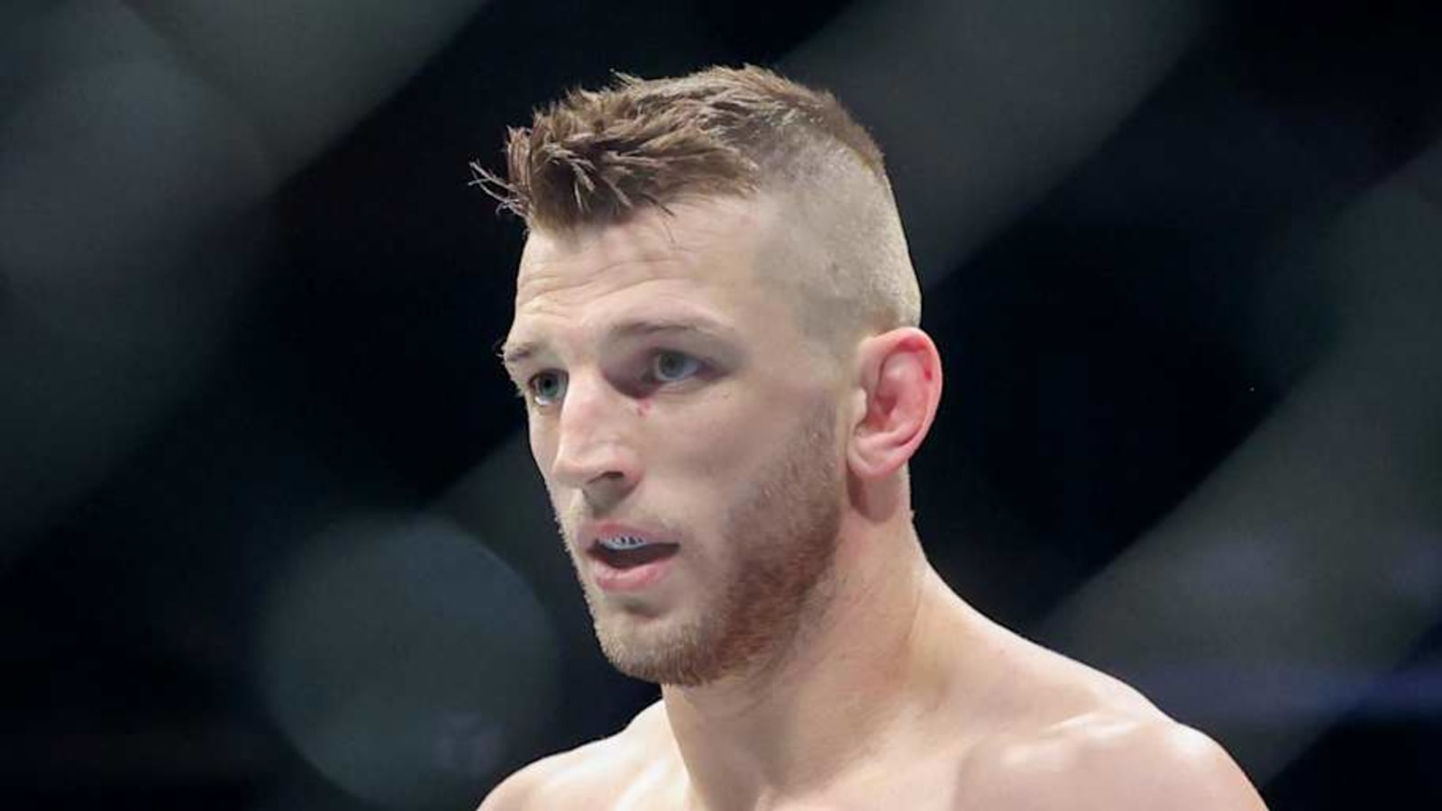 Dan Hooker shares grisly video update of hand injury that forced him off UFC 313