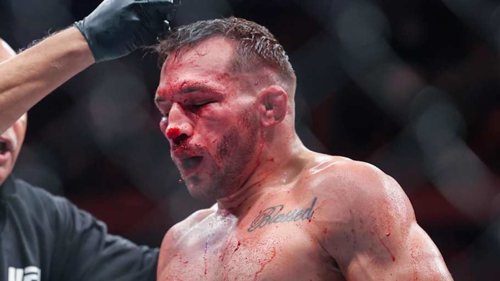 Michael Chandler clears air on cheating controversies ahead of UFC 314