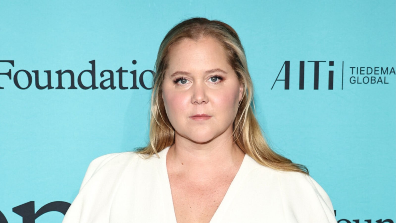 Amy Schumer: Trolls prompted my Cushing syndrome diagnosis