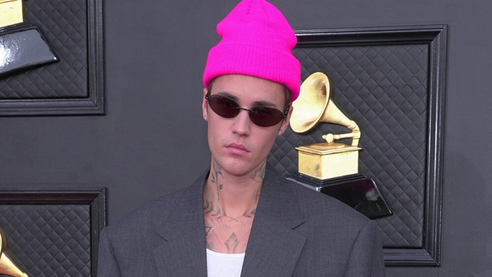 Justin Bieber has &#39;anger issues&#39;