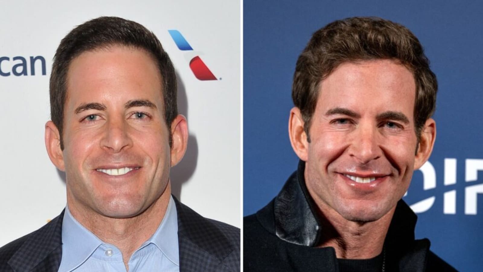 Tarek El Moussa Gets Candid About Cosmetic Procedures Amid ‘Toupee’ Rumors