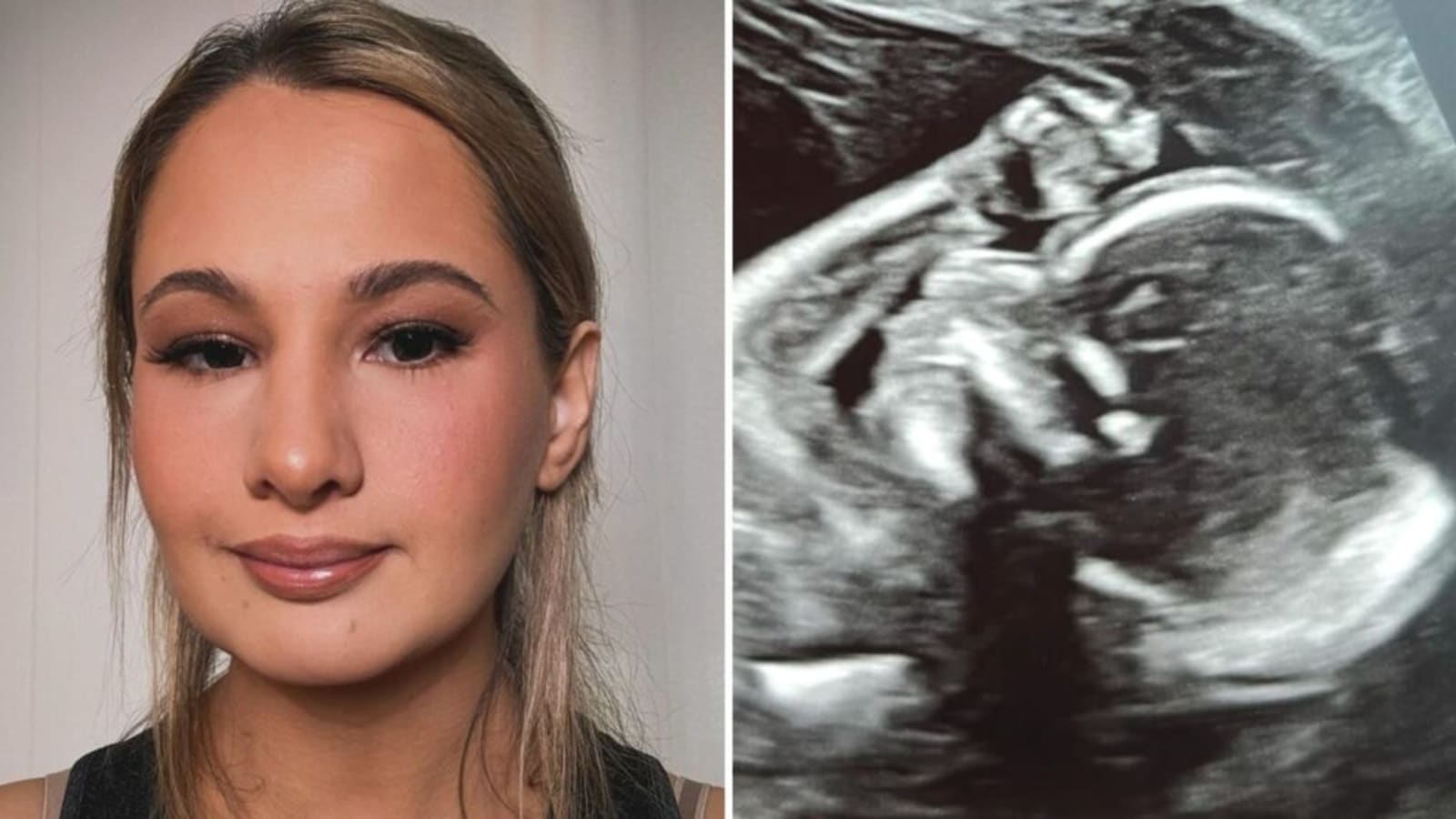Gypsy-Rose Blanchard Shares Ultrasound – Fans Notice One Thing About Baby