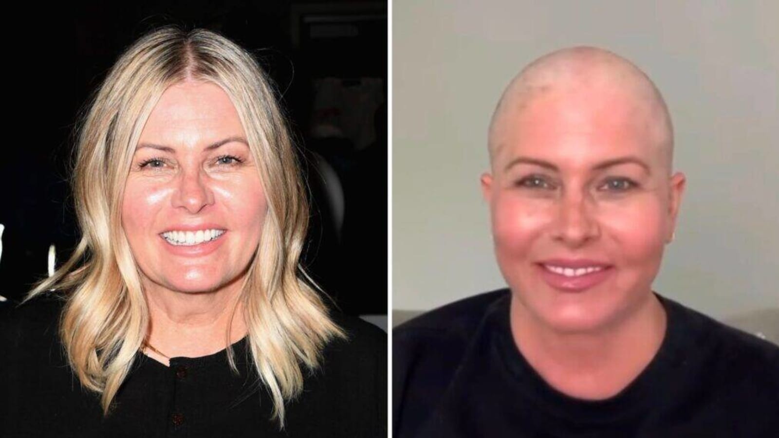 ‘Baywatch’ Star Nicole Eggert Shares Video Shaving Head Amid Cancer Battle