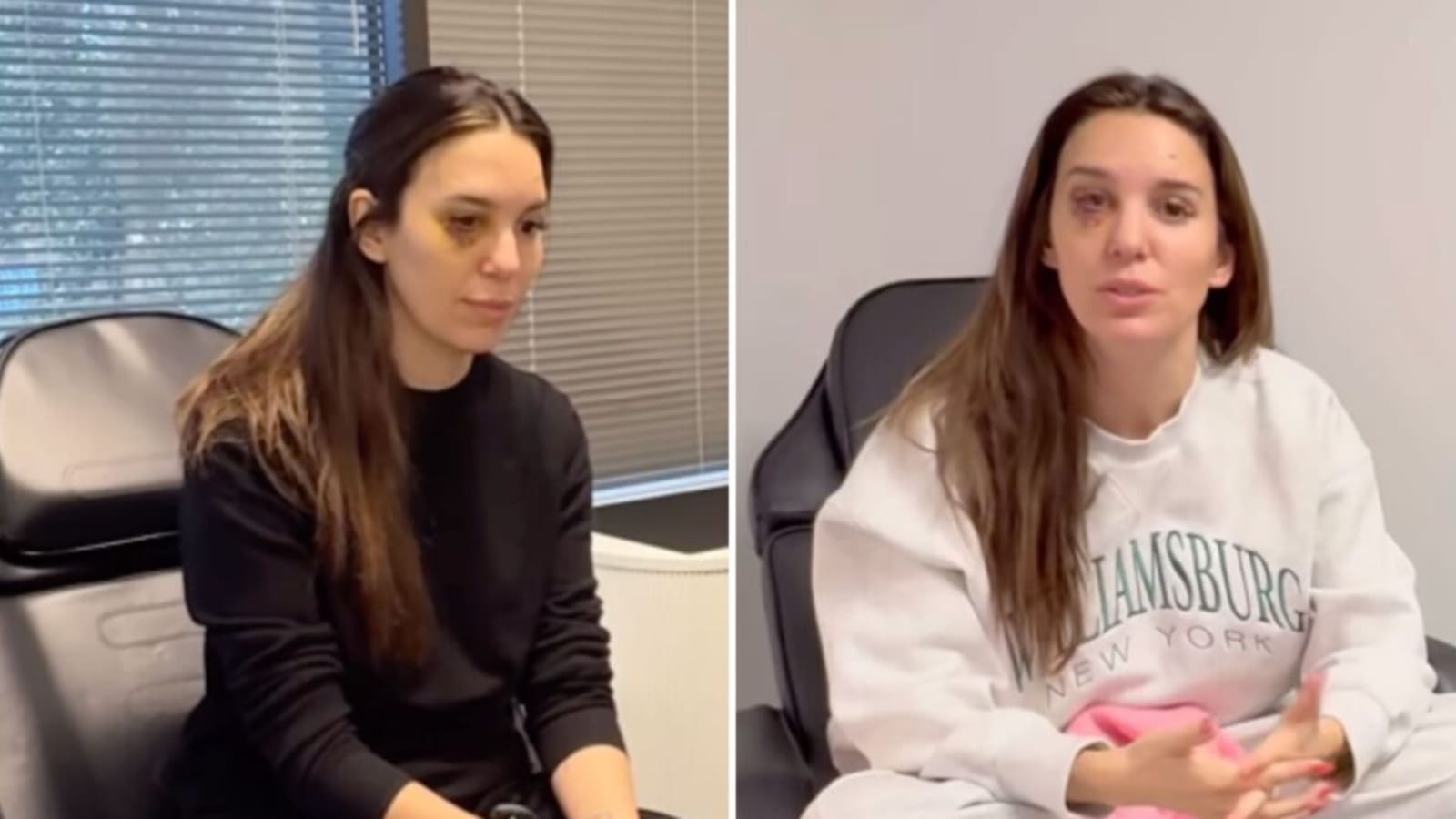Christy Carlson Romano Offers Eye Injury Update, Says Surgery Could Leave Her Blind
