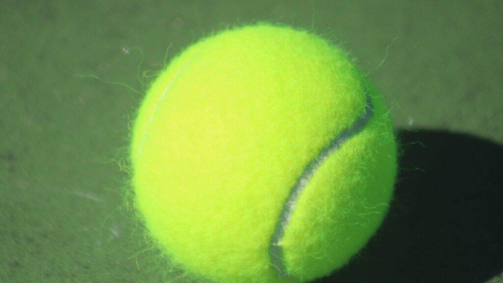 Tennis News Weekly Roundup: Former World No.1 Undergoes Surgery, Maria Sharapova Nominated