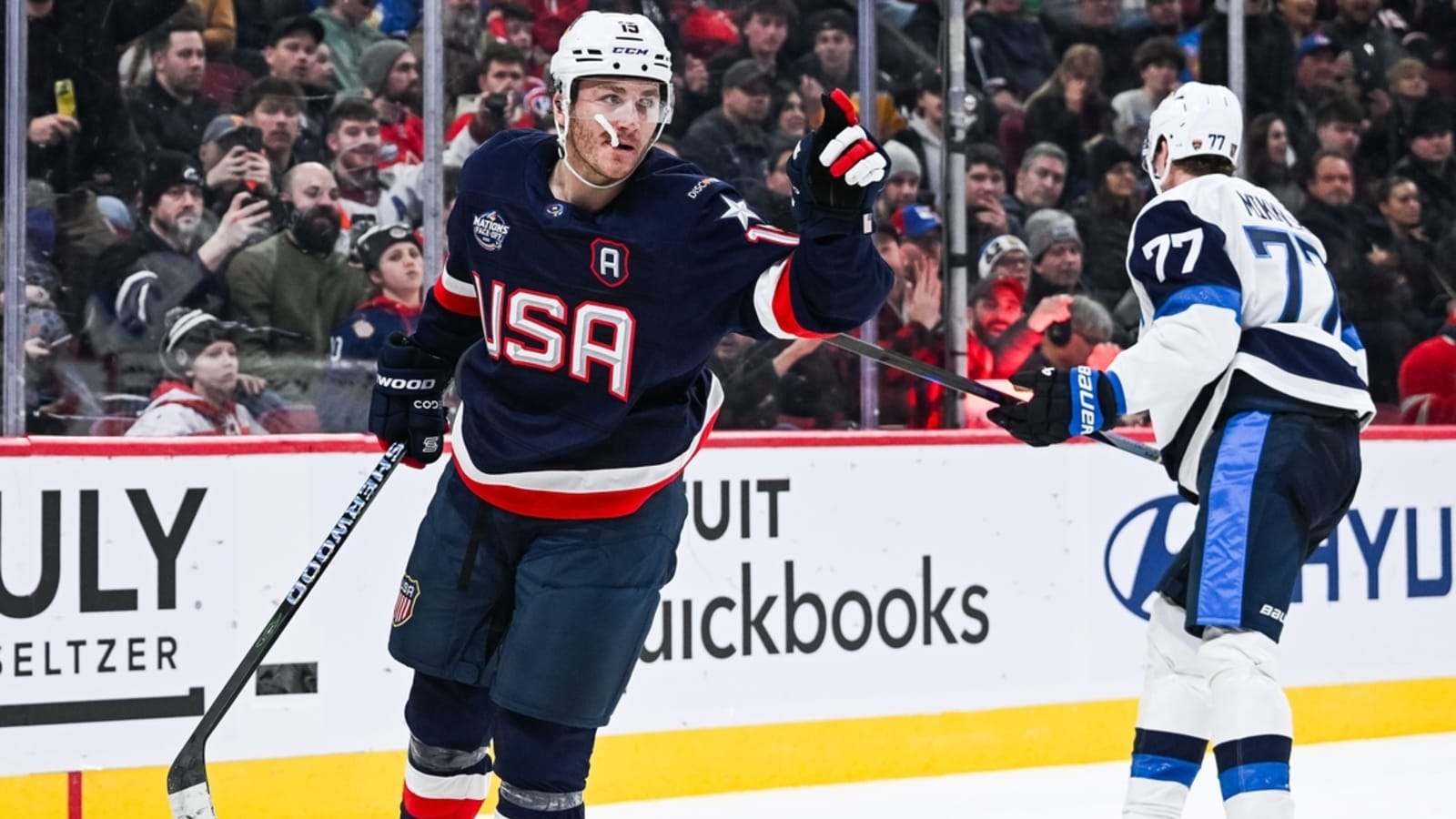 Team USA&#39;s Matthew Tkachuk downplays injury after win