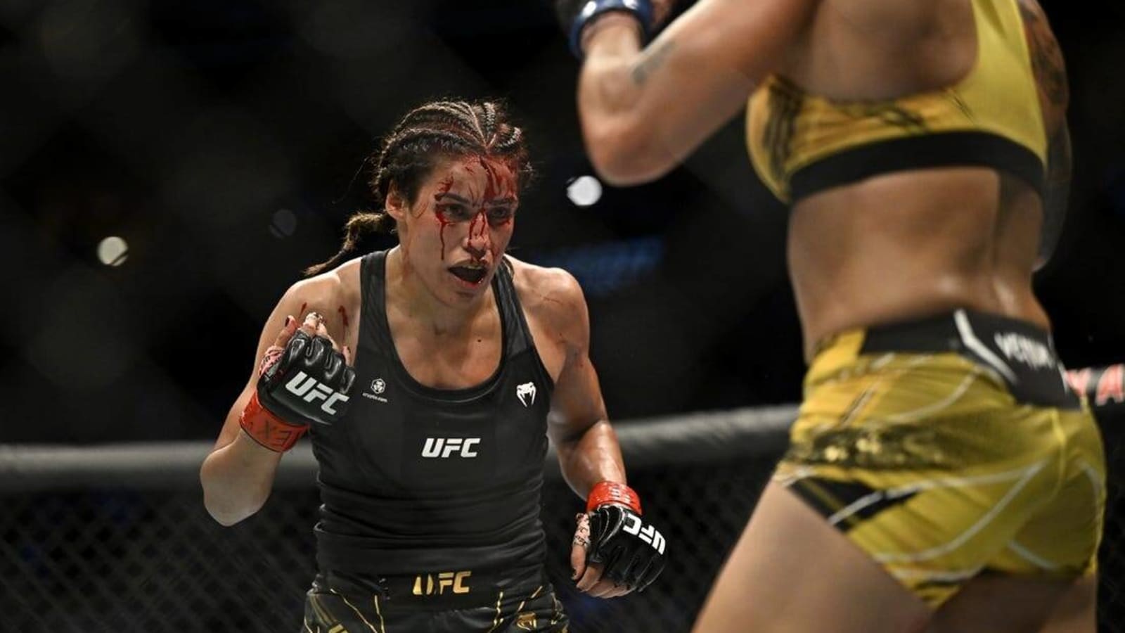 Julianna Pena sees surgeon after loss in UFC 277