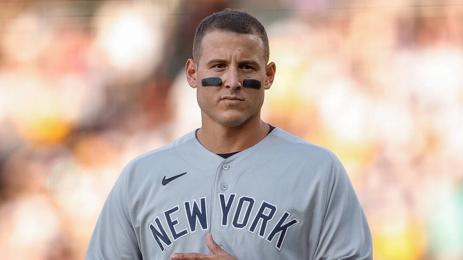 Yankees' Anthony Rizzo played through post-concussion syndrome for