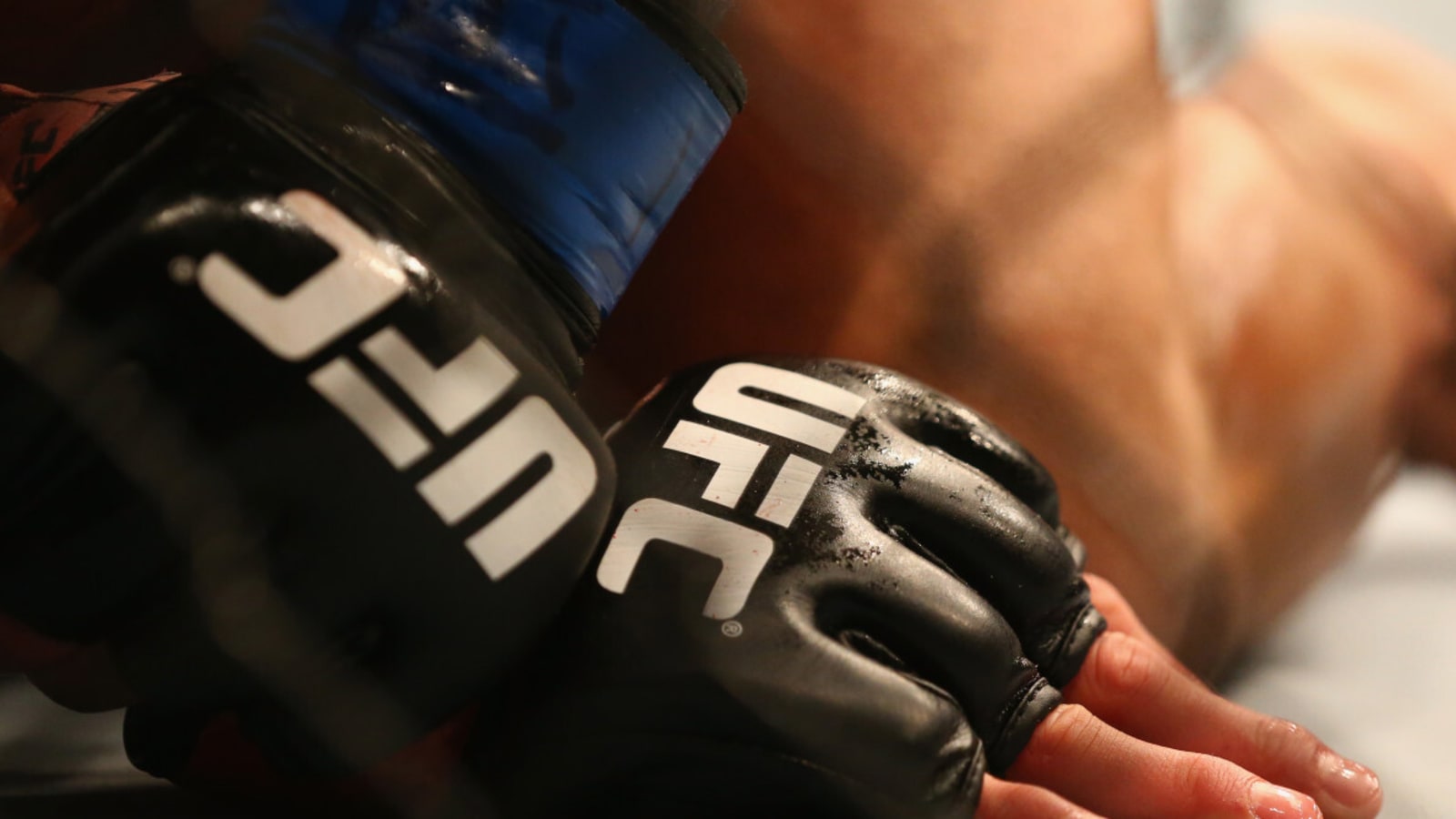 UFC Top Contender Shared Gruesome Hand Injury Update