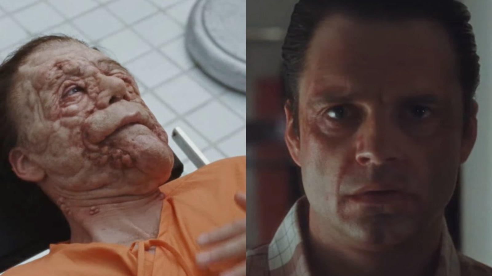 Sebastian Stan Changes His Face and (Maybe) Ruins His Life in A DIFFERENT MAN Trailer