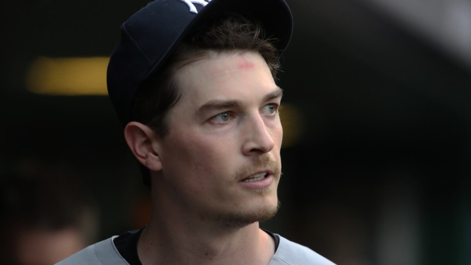 Max Fried lasted just three innings as blister concerns flared in rare rough outing.