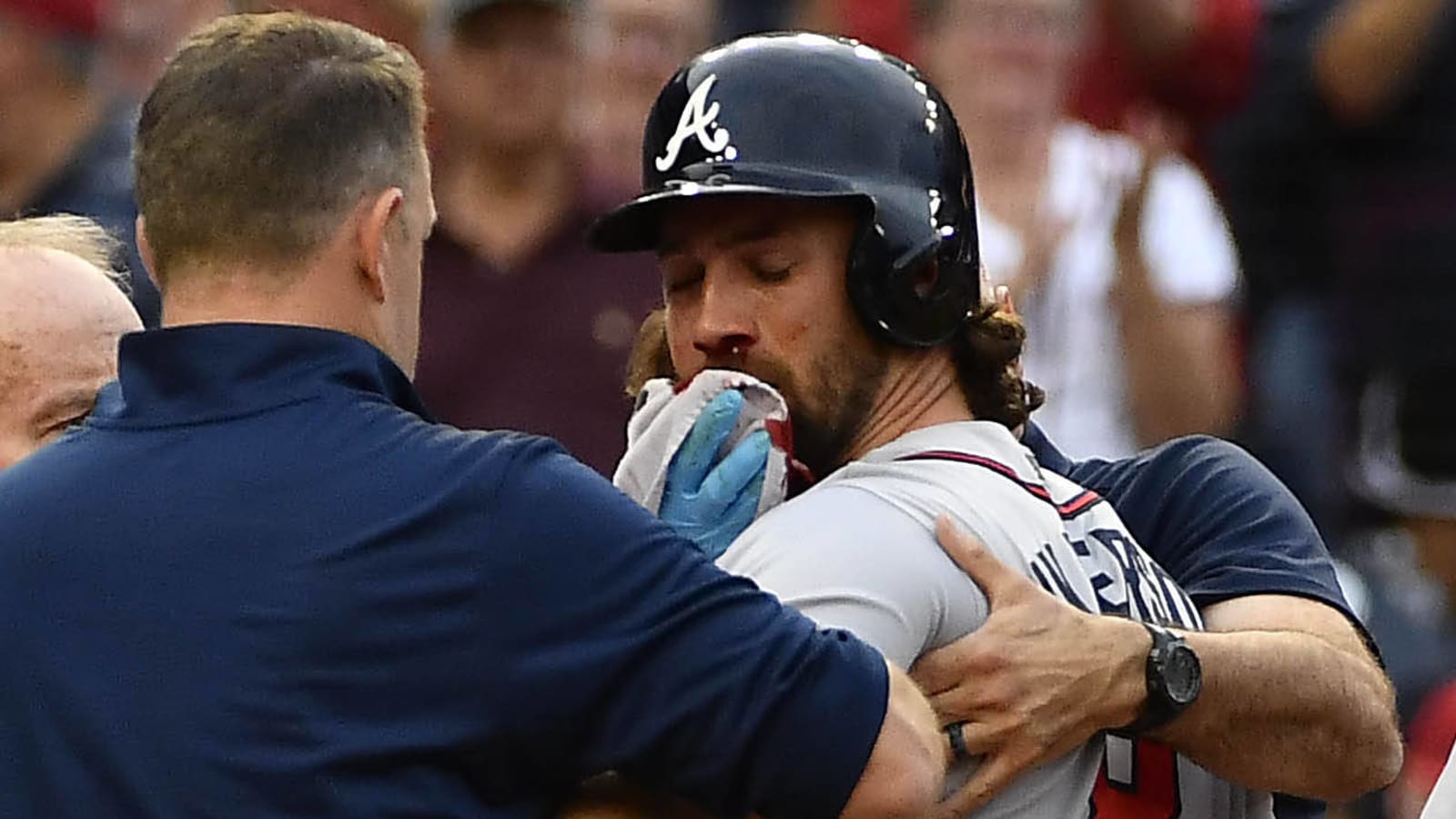 Braves Charlie Culberson Getting Hit in the Face 
