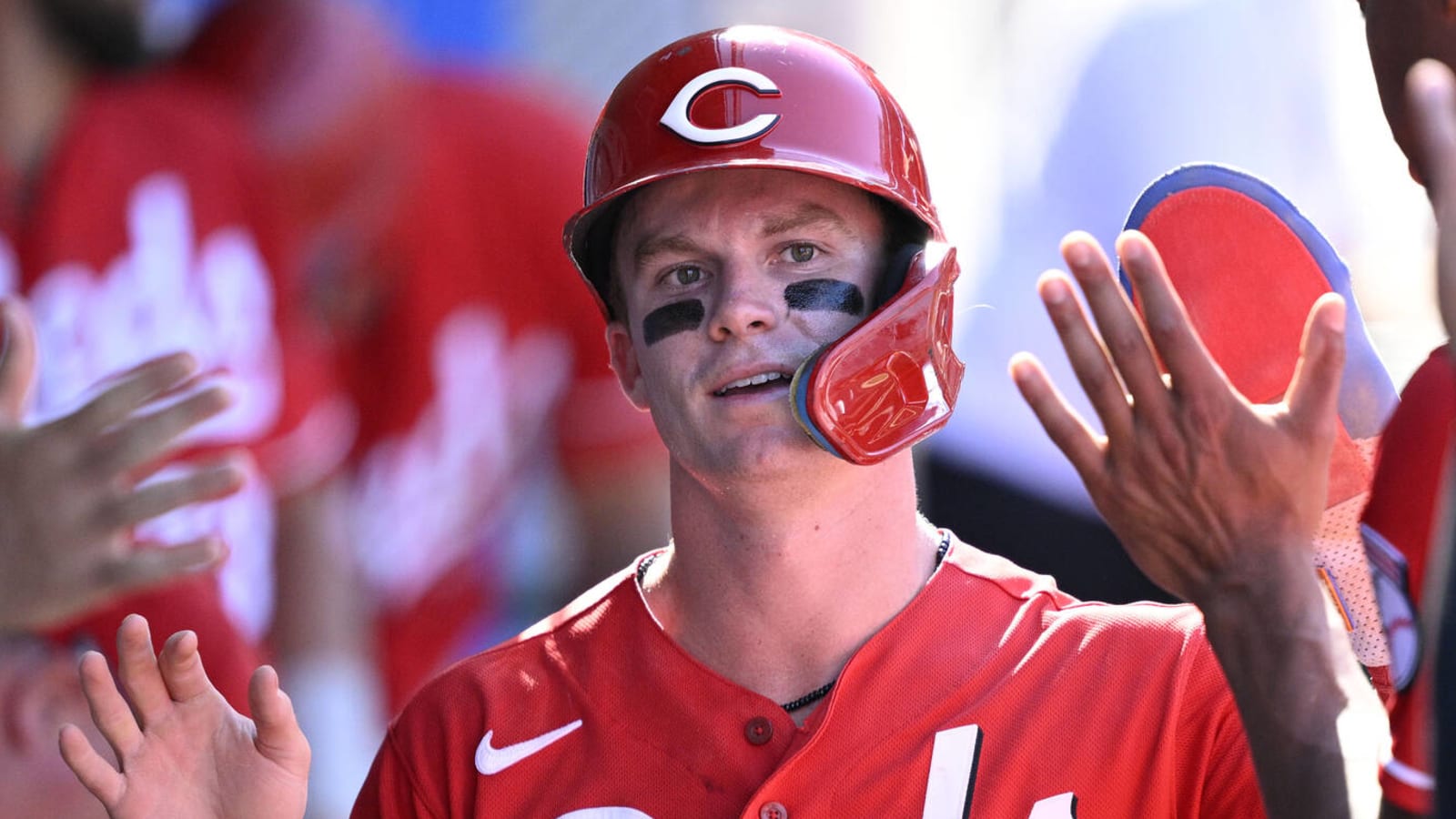 Reds second baseman undergoes shoulder surgery