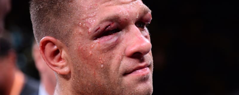 Christian Mbilli vs. Sergiy Derevyanchenko: Preview, odds and fight card